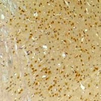 Polyclonal Rabbit anti-Human GABRA4 Antibody (IHC, WB)
