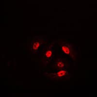 Polyclonal Rabbit anti-Human CFL1 / Cofilin Antibody (phospho-Ser3, IHC, IF, WB)