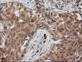 MAPRE2 / EB2 Antibody (clone OTI5F3)