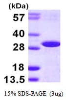 Human DCUN1D2 Protein (Recombinant His)