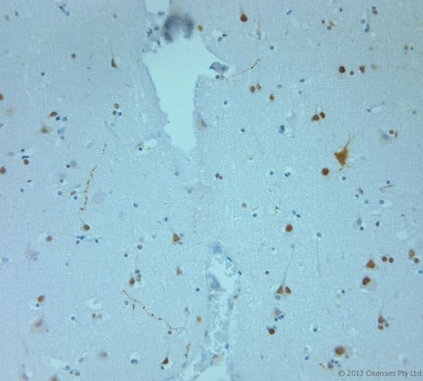 REEP6 Antibody (aa2-50)