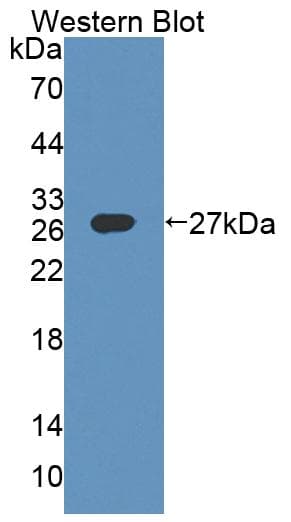 DMPK / DM Antibody (aa1-201)