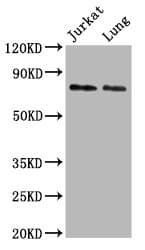 UNC84B / SUN2 Antibody