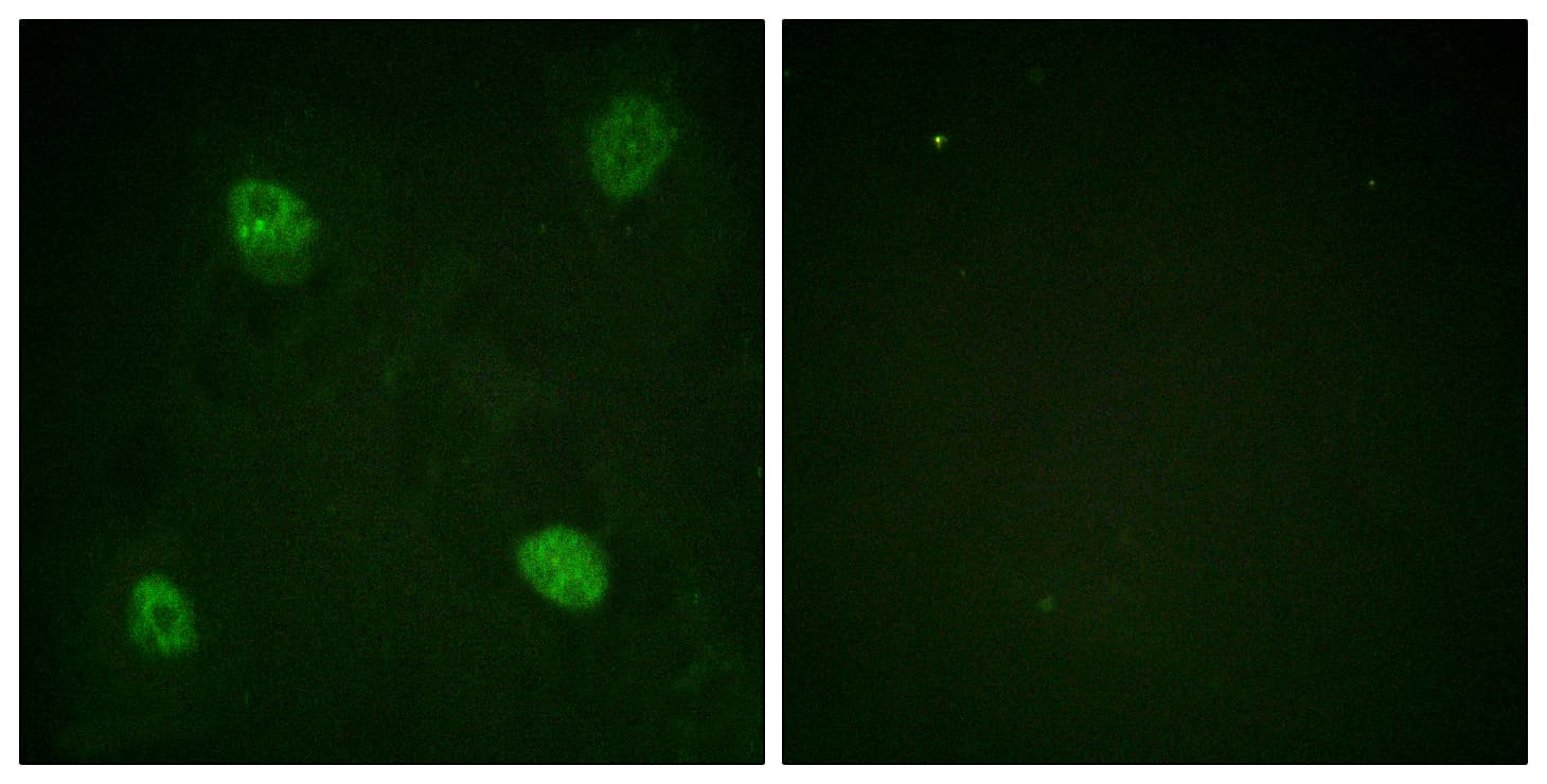 HNRNPD / AUF1 Antibody (phospho-Ser83)