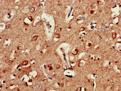 Polyclonal Rabbit anti-Human AP50 / AP2M1 Antibody (IHC, WB)