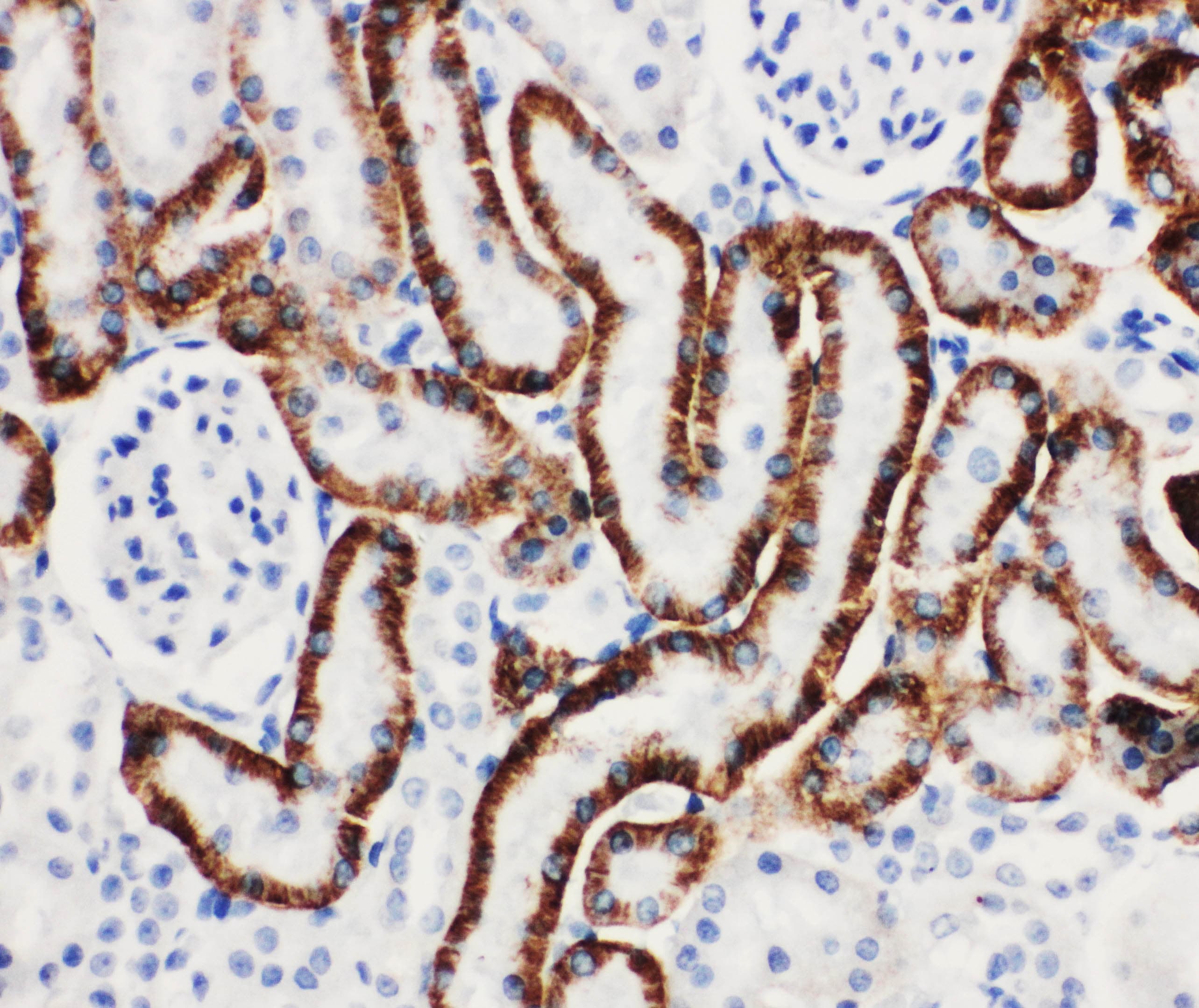 SLC22A6 / OAT1 Antibody (aa534-550)