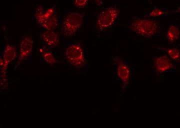 KLKB1 / Plasma Kallikrein Antibody