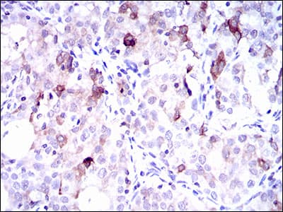 Monoclonal Mouse anti-Human SLC27A5 / BACS Antibody (clone 9C4D1, aa508-570, IHC, WB)