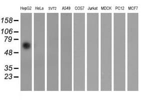 FTCD / 58K Golgi Protein Antibody (clone OTI4C3, Carrier-free)