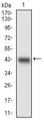 MLXIPL / CHREBP Antibody (aa18-143, clone 5D12D1)