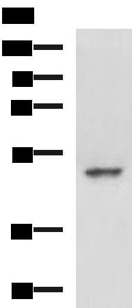 Polyclonal Rabbit anti-Human MYCN / N-myc Antibody (WB)