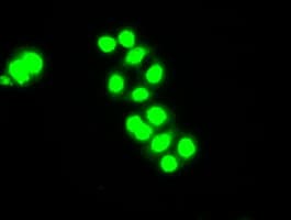 CHEK2 / CHK2 Antibody (clone OTI10G7)