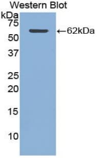 CTSA / Cathepsin A Antibody (aa215-470, Biotin)