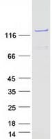 Human PHKA2 Protein (Recombinant Myc-DDK (Flag))