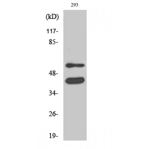 Polyclonal Rabbit anti-Human GSK3 Alpha+Beta Antibody (220-300 aa, IHC, WB)