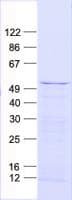 Human ZIC / ZIC1 Protein (Recombinant His, N-Terminal)