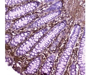 Polyclonal Rabbit anti-Human ANXA6/Annexin A6/Annexin VI Antibody (IHC, WB)