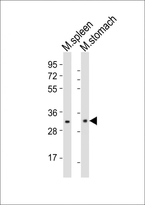 NKX2-5 Antibody (aa98-133)