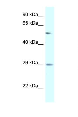 AMY2B Antibody (aa130-179)