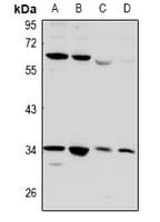 Polyclonal Rabbit anti-Human CD32B Antibody (WB)