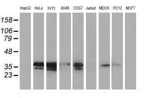 MAPRE2 / EB2 Antibody (clone OTI3C7)