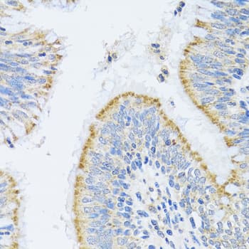 Polyclonal Rabbit anti-Human MMP19 Antibody (IHC, WB)