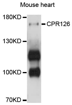 IHC-plus™ Polyclonal Rabbit anti-Human ADGRG6 / GPR126 Antibody (IHC, WB)