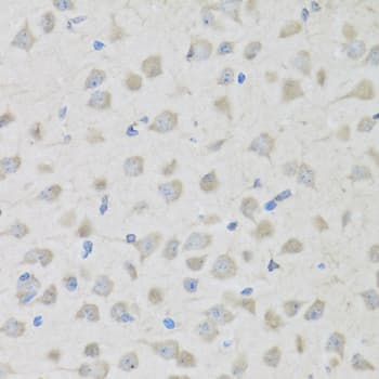 PathPlus™ Proenkephalin / PENK Antibody (aa 25-267)