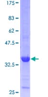 Human CKS1B / CKS1 Protein (Recombinant GST)