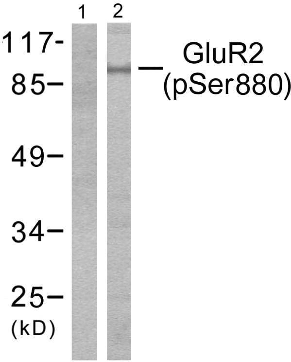 Polyclonal Rabbit anti-Human GRIA2 / GLUR2 Antibody (phospho-Ser880, IHC, WB)