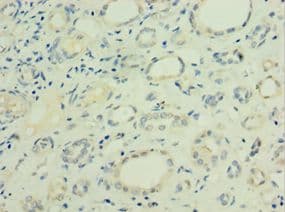 Polyclonal Rabbit anti-Human LGALS9 / Galectin 9 Antibody (aa1-240, IHC, WB)