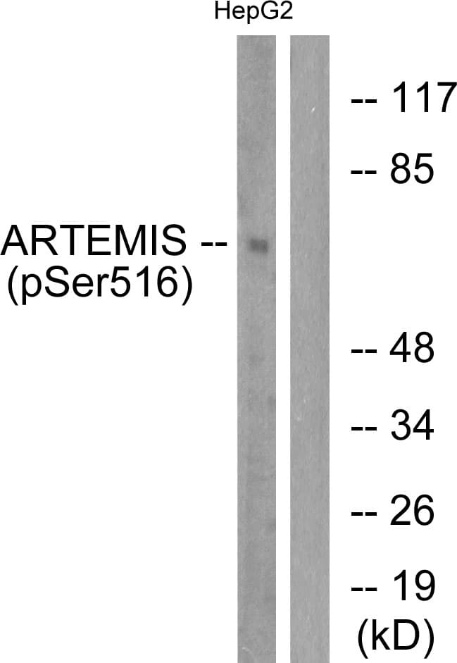 Polyclonal Rabbit anti-Human DCLRE1C / Artemis Antibody (phospho-Ser516, IHC, WB)