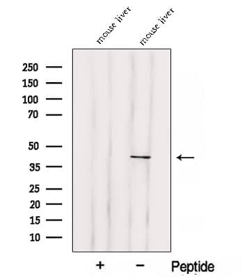 SOAT2 Antibody