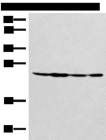 Polyclonal Rabbit anti-Human SSSCA1 / p27 Antibody (IHC, WB)