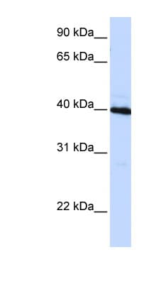 C/EBP Beta / CEBPB Antibody (aa72-121)