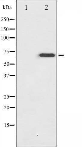 Polyclonal Rabbit anti-Human NF2 / Merlin Antibody (phospho-Ser518, IF, WB)