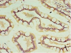 Polyclonal Rabbit anti-Human IL37 Antibody (aa1-218, IHC)