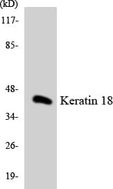 PathPlus™ KRT18 / CK18 / Cytokeratin 18 Antibody (aa48-97)