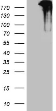 TP53BP1 / 53BP1 Antibody (aa1-300, clone OTI9C8)