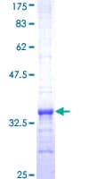Human MS4A2 / FCERI Protein (Recombinant GST, N-terminus)