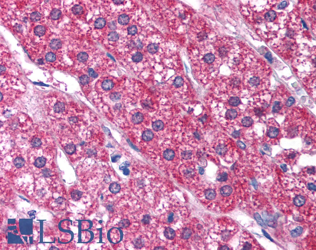 P2RX2 / P2X2 Antibody (aa55-104)