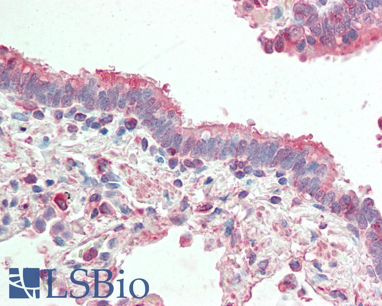 IHC-plus™ APG4B / ATG4B Antibody