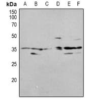 OTUB1 / OTU1 Antibody