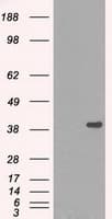 DNTTIP1 / TDIF1 Antibody (clone OTI1E2)