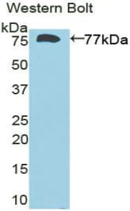 DIO3 Antibody (aa11-277, PE)