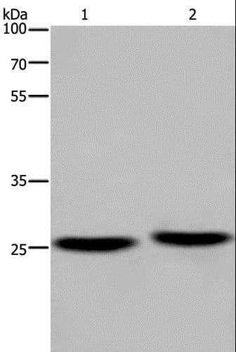 IHC-plus™ Polyclonal Rabbit anti-Human EPDR / EPDR1 Antibody (IHC, WB)