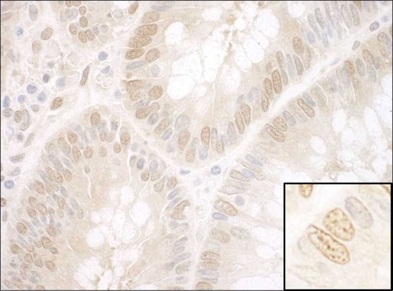 NPAT Antibody (aa700-750)