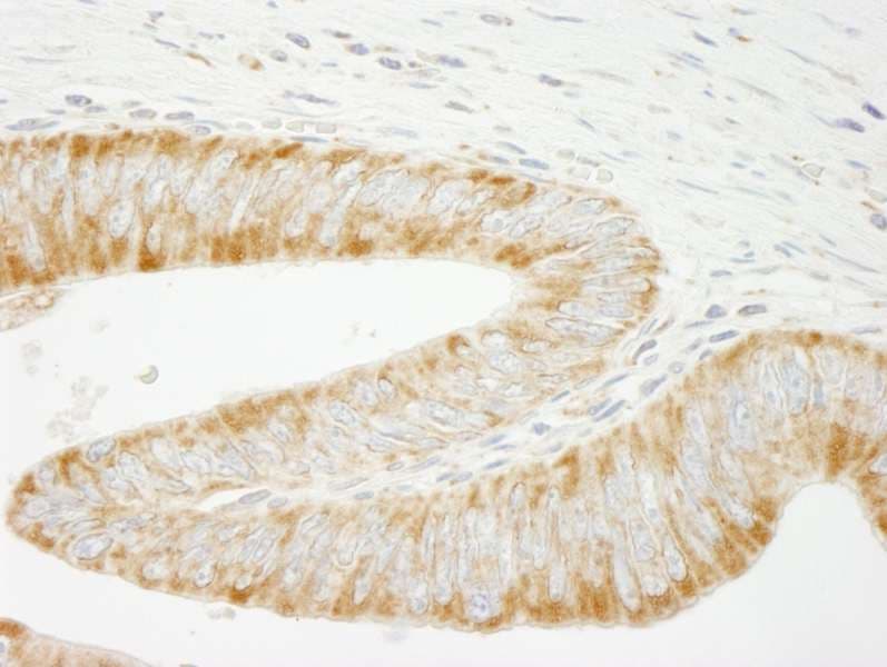 Polyclonal Rabbit anti-Human INPPL1 / SHIP2 Antibody (aa100-150, IHC)