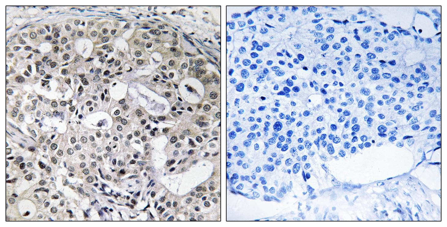 Polyclonal Rabbit anti-Human CNTD2 Antibody (IHC)