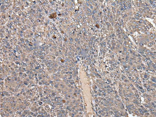 ATAD1 Antibody